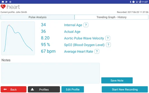Unduh iHeart Internal Age Terbaru – Pantau Kesehatan Anda - Screenshot 9